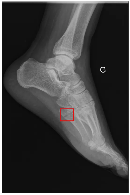 Example of an annotated image (label)